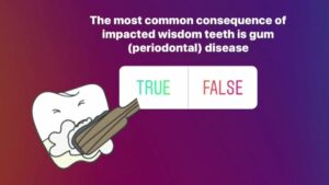 Removal of Impacted Wisdom Teeth
