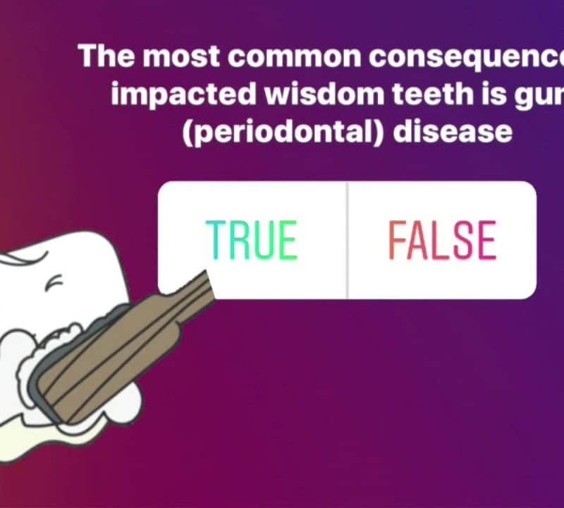 Removal of Impacted Wisdom Teeth