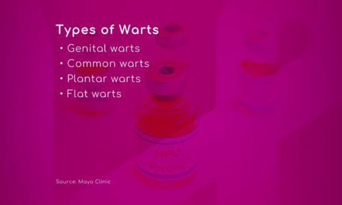HPV: Types of Warts