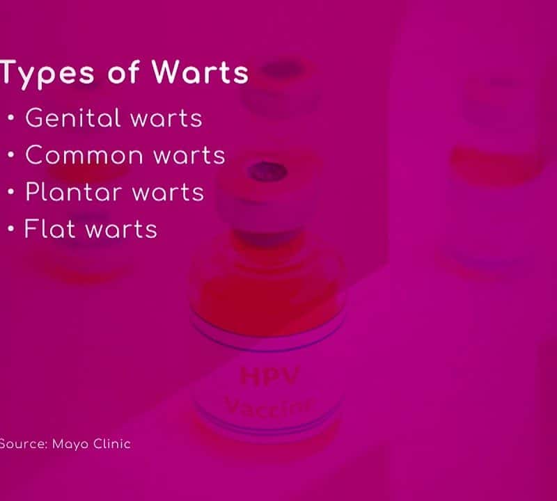 HPV: Types of Warts