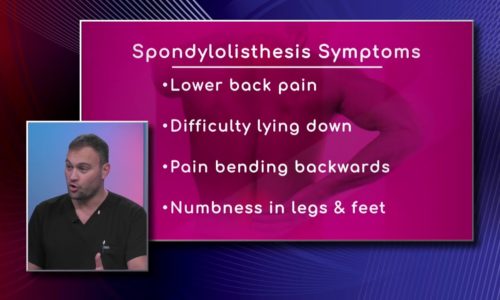 Symptoms of Spondylolisthesis