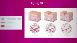 Dermatology: Aging Skin