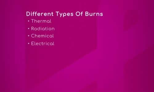 Different Types of Burns