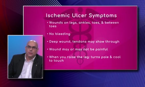 Symptoms of Ischemic Ulcer