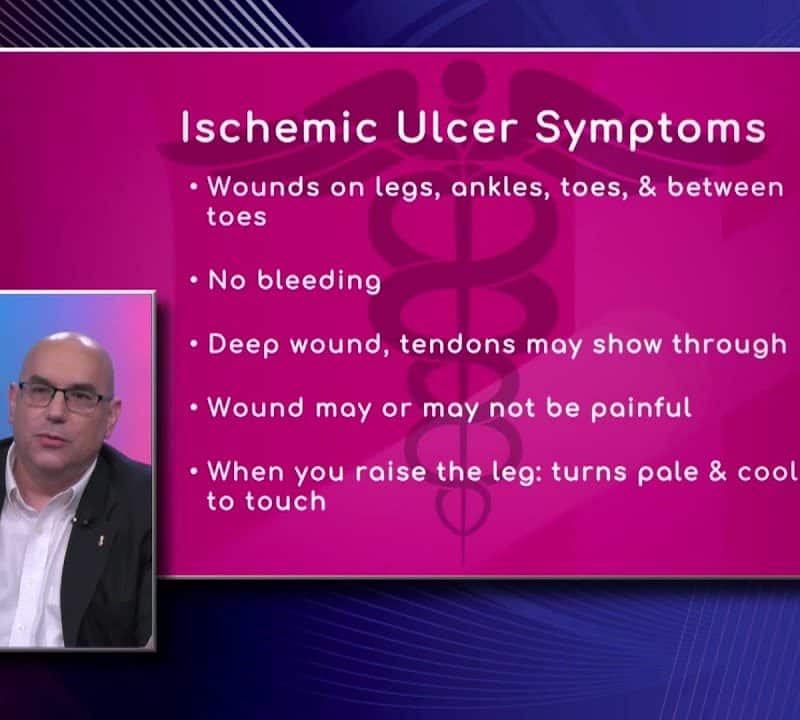 Symptoms of Ischemic Ulcer