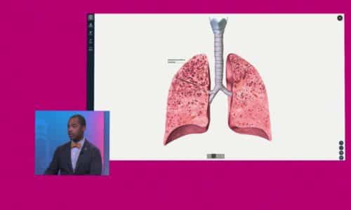COPD vs. Emphysema