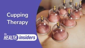 Benefits of Cupping Therapy