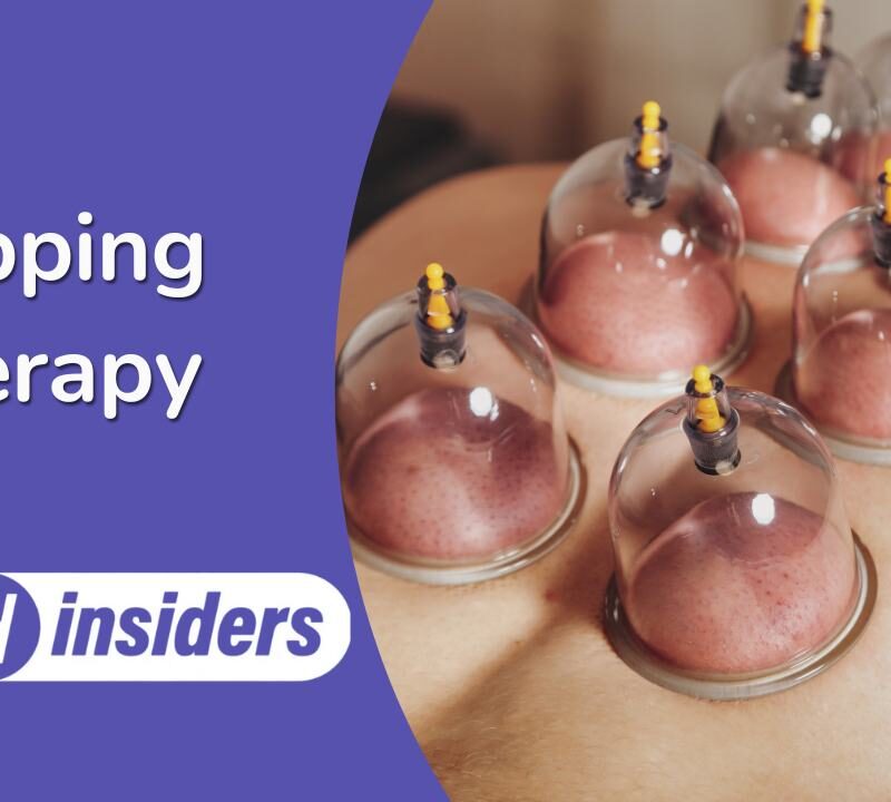 Benefits of Cupping Therapy