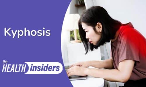 Spine Disease: Kyphosis