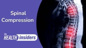 Spinal Compression Risk Factors