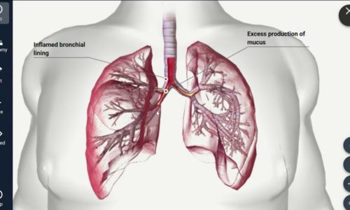 The Effects in Smoker Lungs