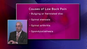 Causes of Low Back Pain