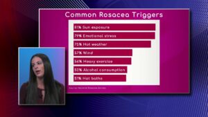 Causes of Rosacea