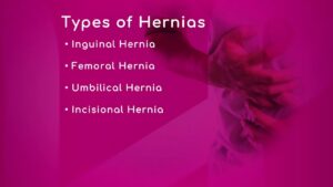 Hernia Surgery Procedure