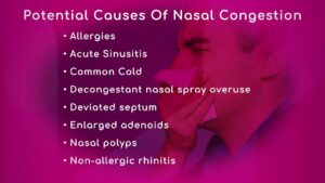 Causes of Nasal Congestion