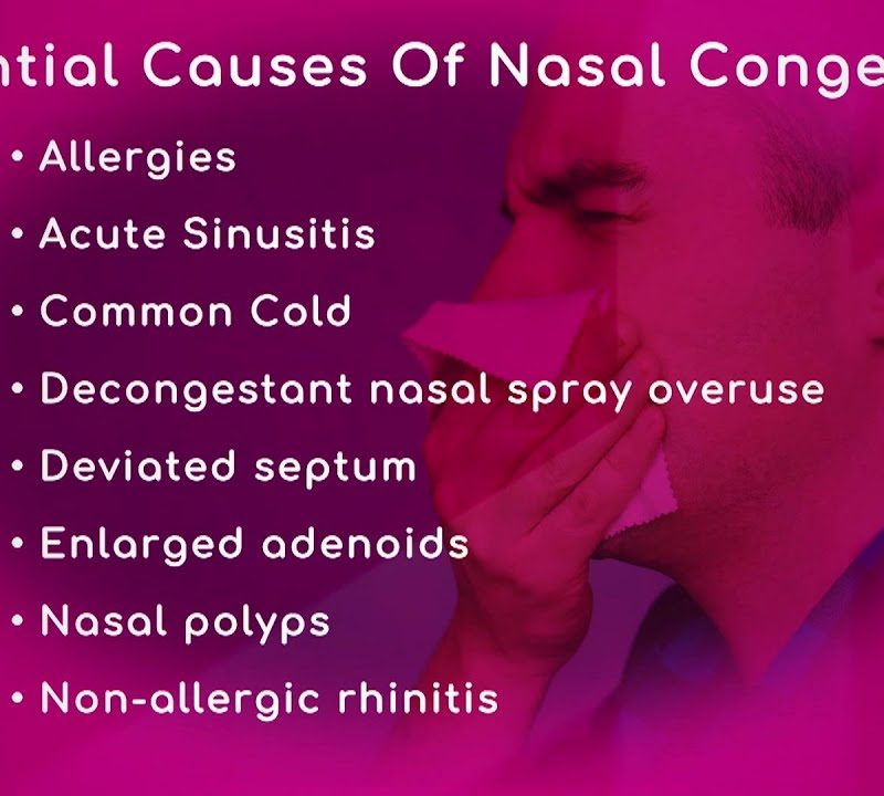 Causes of Nasal Congestion