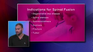 Indications for Spinal Fusion