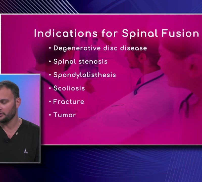 Indications for Spinal Fusion