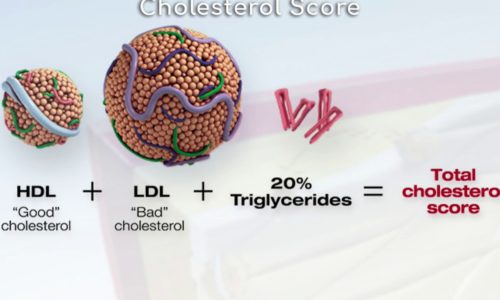 Total Cholesterol Score