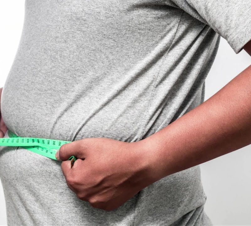 Men: Fat Reduction Options