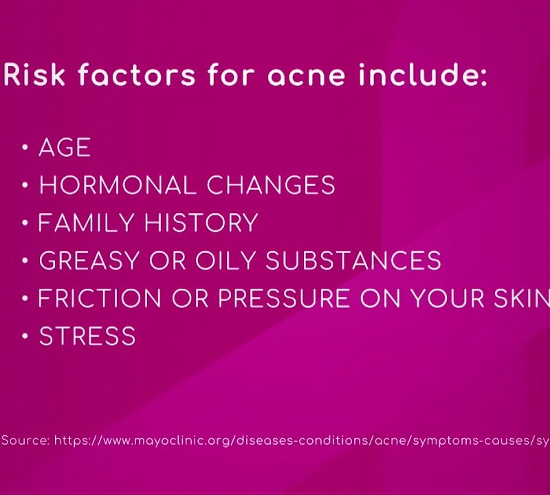 Risk Factors for Acne