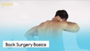 The Basics of Back Surgery l Smart Life
