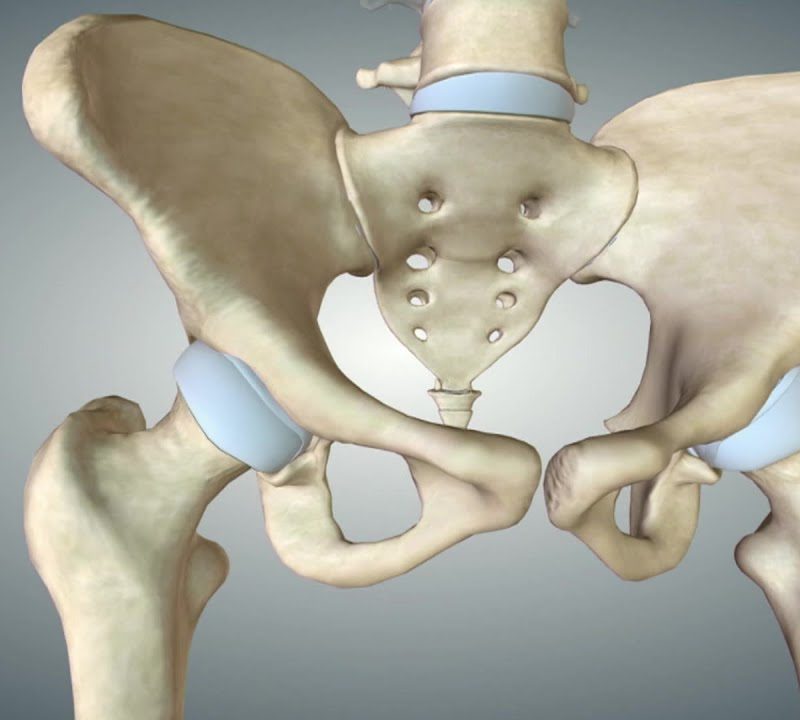 Osteoarthritis and the Hip