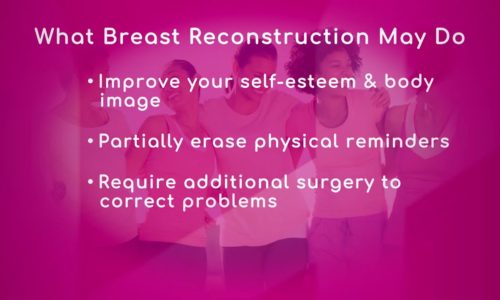 Benefits of Breast Reconstruction