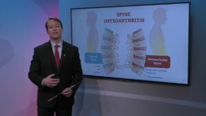 Spine and Osteoarthritis