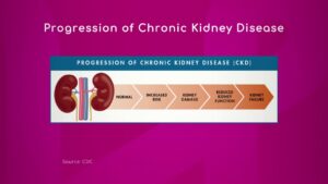 Progression of Chronic Kidney Disease