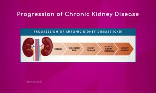 Progression of Chronic Kidney Disease