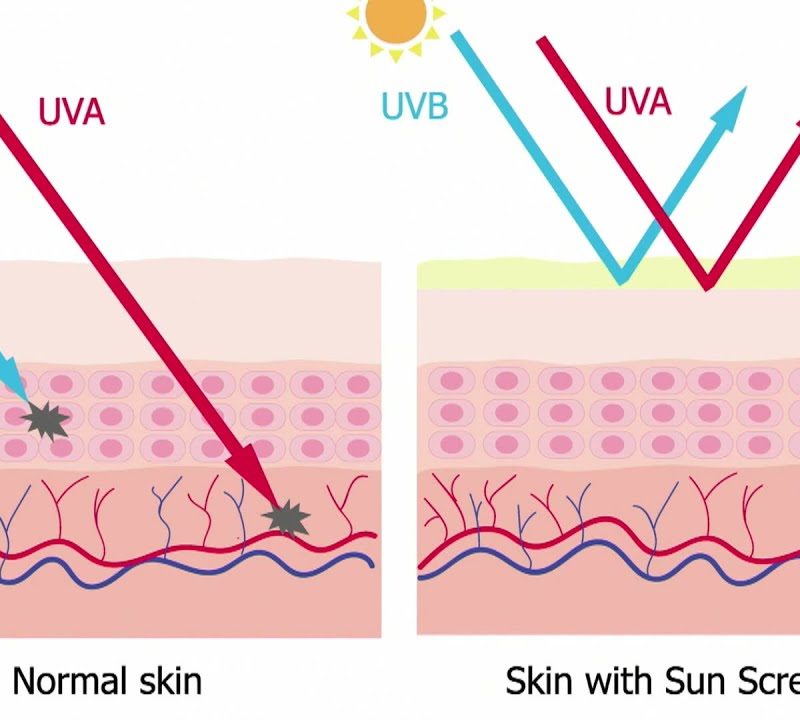 Effects of Sun Exposure