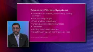 Symptoms of Pulmonary Fibrosis
