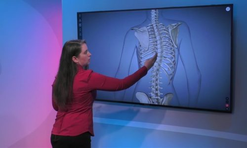 Overview of Scoliosis