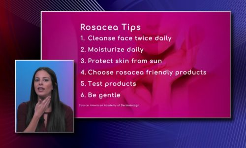Skin Care Tips for Rosacea
