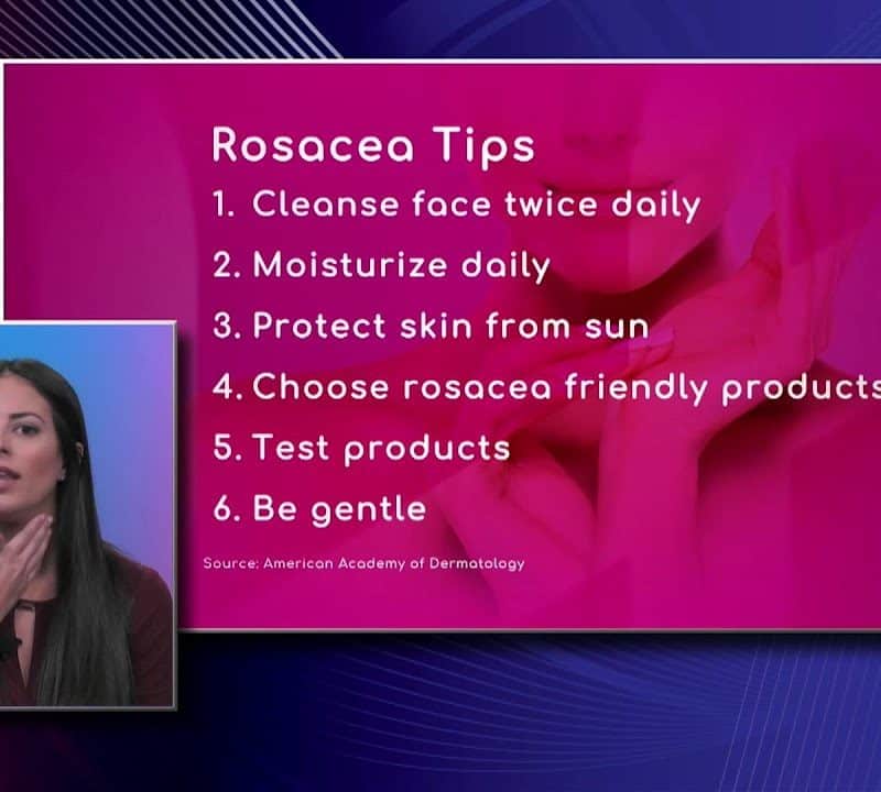 Skin Care Tips for Rosacea
