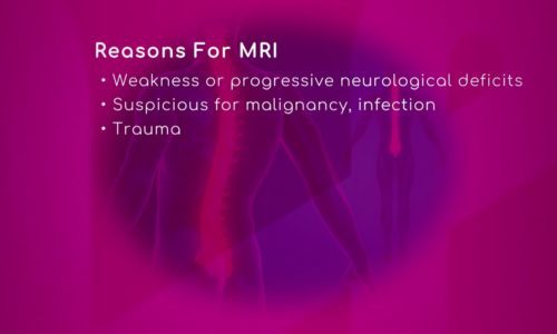 M.R.I and Low Back Pain