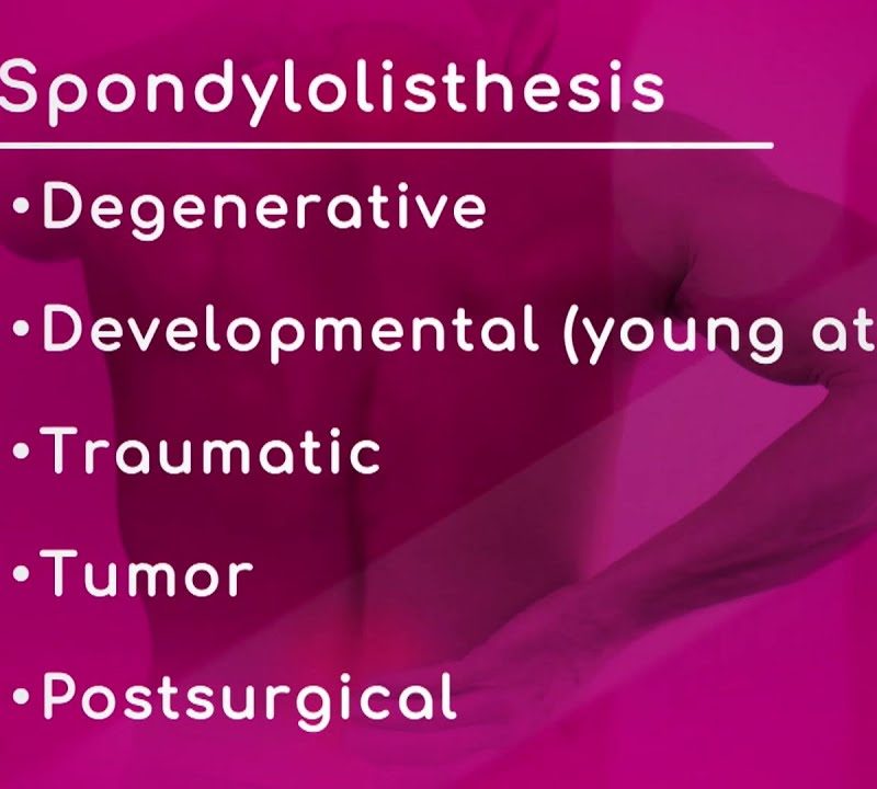 Types of Spondylolisthesis