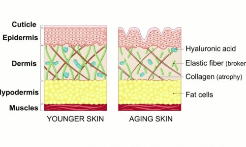 Skin Tightening Results
