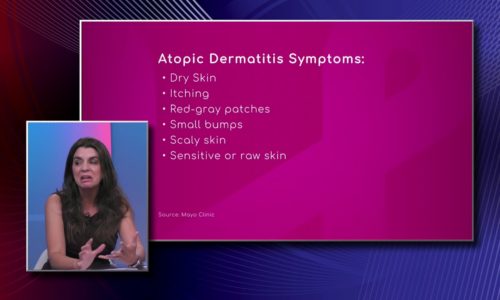 Atopic Dermatitis Symptoms
