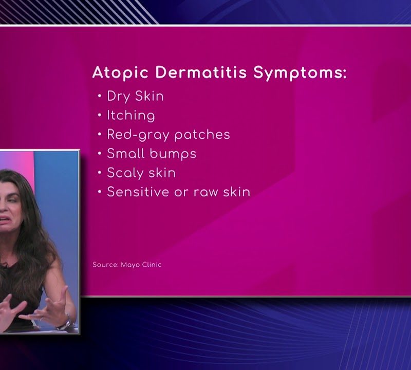 Atopic Dermatitis Symptoms