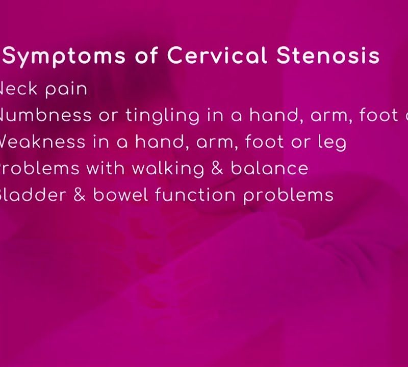 Symptoms of Cervical Spinal Stenosis