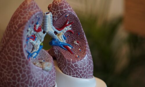 A New Way to Treat Emphysema