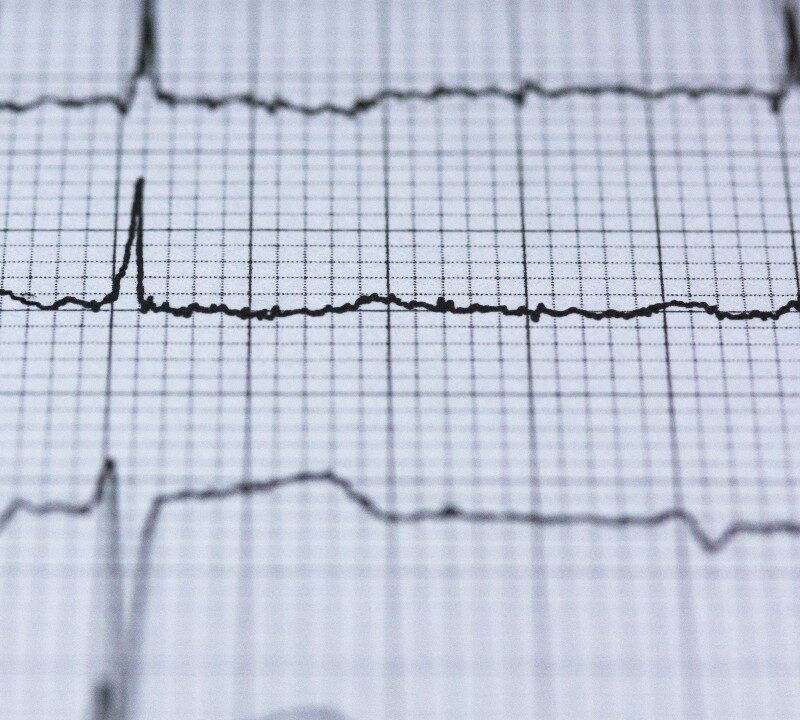 Correcting a Potentially Fatal Heart Rhythm