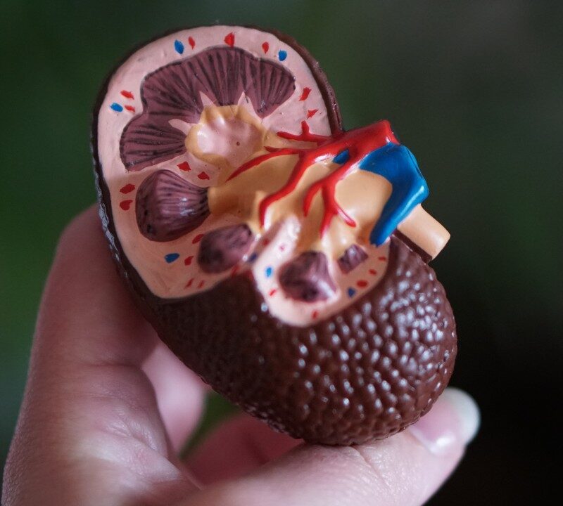 Lifesaving Kidney Transplant