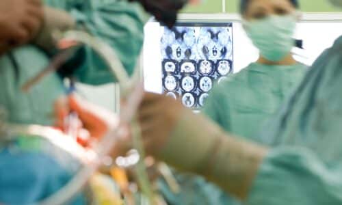 Tracking Brain Surgery When Patients Are Wide Awake