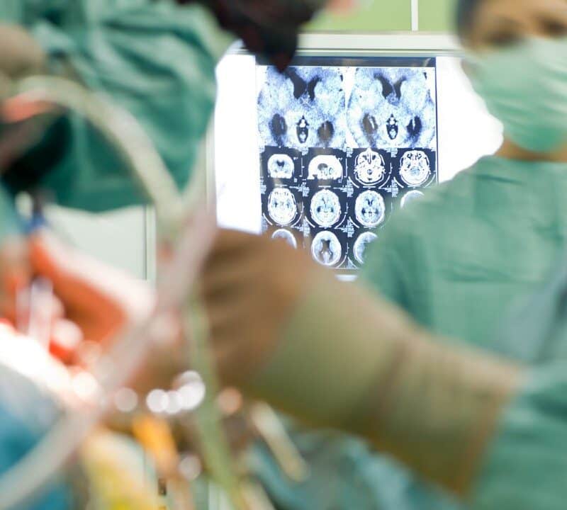 Tracking Brain Surgery When Patients Are Wide Awake