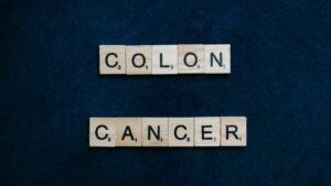 New Rules To Help Stop Cancer Of The Colon
