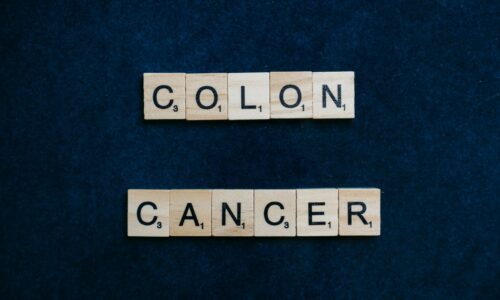 New Rules To Help Stop Cancer Of The Colon
