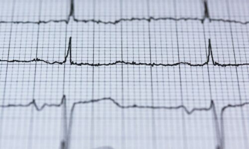 Reducing the Risk of Heart Attacks and Strokes